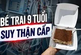 Trung Quốc: Bé trai 9 tuổi suy thận cấp sau khi ăn 1 chiếc bánh