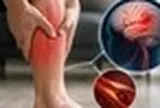 Chuyên gia cảnh báo: 5 dấu hiệu tại BẮP CHÂN có thể là tín hiệu cảnh báo đột quỵ, nếu thấy phải đi kiểm tra ngay