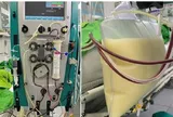 Nam giám đốc 36 tuổi suýt tử vong, "máu đục như sữa" vì mê uống "loại nước quen thuộc" này