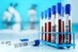 5 xét nghiệm nên làm khi bước sang tuổi 35