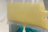 Nam thanh niên "máu trắng đục như sữa" vì ăn thứ quen thuộc nhiều người mê