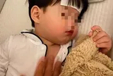 Bé 3 tuổi nuốt phải pin cúc áo, người mẹ "cấp cứu" bằng 1 thìa gia vị trước khi đến viện, bác sĩ khen: "Rất giỏi!"