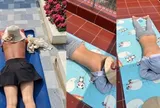 Cảnh báo nguy cơ sức khỏe từ trào lưu "phơi nắng giữa trưa"