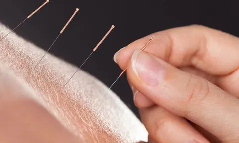 Người đàn ông 47 tuổi phải cắt một bên chân sau khi đi châm cứu