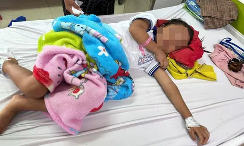 Cháu bé 7 tuổi nhập viện với 200 vết ong đốt gây bội nhiễm, tổn thương giác mạc