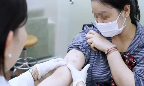 Hãi hùng khi thân thể biến dạng sau tiêm 'tan mỡ siêu tốc' tại spa trôi nổi