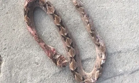 Người đàn ông 27 tuổi suýt mất mạng vì tự ý chữa bệnh theo “kiểu lạ đời"