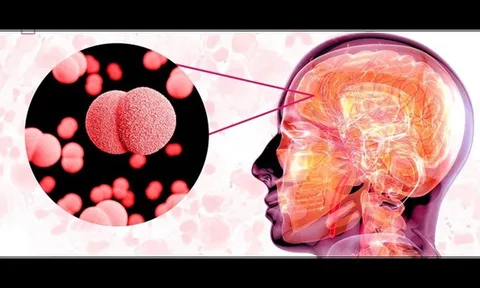 Bệnh nguy hiểm đã có 4 ca không qua khỏi, Viện Pasteur Tp.HCM cảnh báo