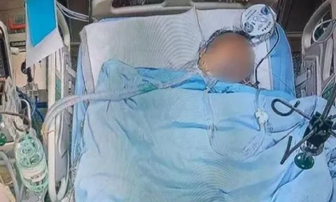 Người đàn ông 57 tuổi tử vong vì thường xuyên ăn 3 món khoái khẩu "vạn người mê"