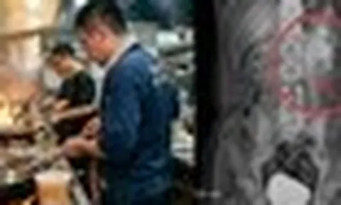 Nam đầu bếp 32 tuổi phù thận cấp tính vì 1 thói quen uống nước không ít người vẫn làm mỗi ngày
