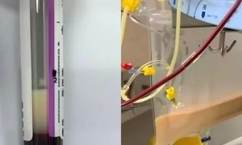 Người phụ nữ ngoài 30 tuổi máu trắng như sữa sau khi uống 4 cốc nước "vạn người mê" trong 1 ngày