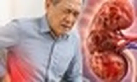 Bác sĩ chỉ: 6 DẤU HIỆU cảnh báo suy thận, nhưng dễ bị người Việt nhầm với vấn đề tuổi tác và mệt mỏi