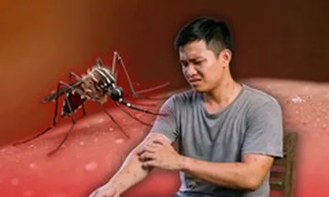 Không phải 'thịt thơm' hay máu O, đây mới là nguyên nhân muỗi 'chọn' bạn để đốt