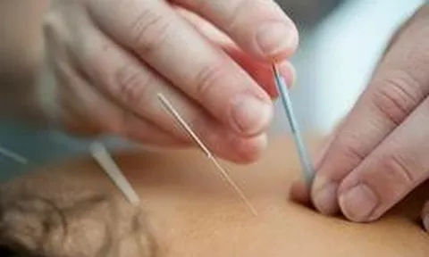 Đau chân dữ dội sau khi châm cứu, người phụ nữ sốc nặng khi biết sự thật đáng sợ