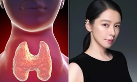 Tuyến giáp rất "ghét" bạn làm 5 việc này, bạn đang mắc bao nhiêu cái?