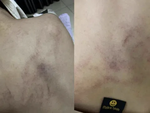Đình chỉ cô giáo bị tố dốc ngược đầu trẻ, ném xuống giường ở Trường Mầm non Gia Thụy