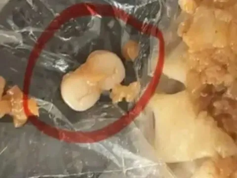 Liên tiếp phát hiện răng người trong xúc xích, dim sum: Người tiêu dùng 'sốc' đặt câu hỏi, nguyên liệu này từ đâu ra?