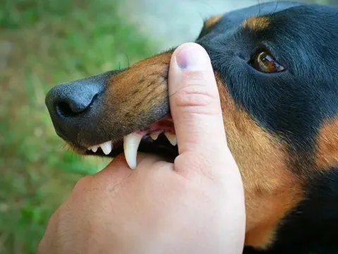 Người đàn ông 51 tuổi tử thương tâm sau khi bị chó "lạ" cắn