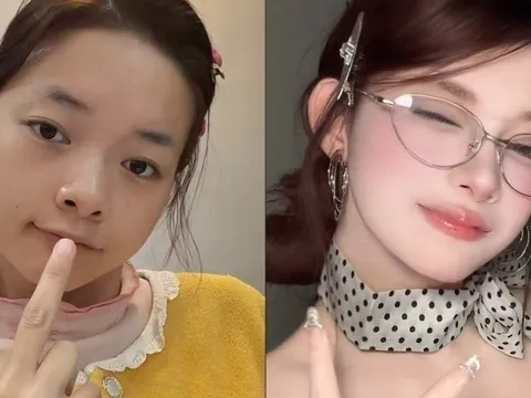 Bị bại não từ nhỏ, cô gái chọn nghề 'không ai ngờ' để trả nợ 1,5 tỷ đồng giúp gia đình