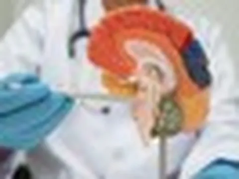 Có 3 thói quen mà đột quỵ "rất thích" - chuyên gia nói thẳng: "Tôi đã tận mắt chứng kiến..."