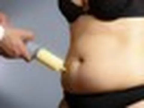 Hút mỡ ra ngoài rồi đem cấp đông bảo quản, đợi chờ làm đẹp trong tương lai: Cảnh báo trào lưu tiềm ẩn rủi ro