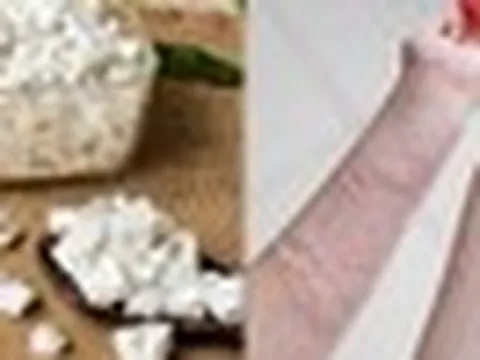 Trong nhà có bột sắn dây: Pha ngay theo cách này để cơ thể THẢI ĐỘC, đánh bay mẩn nNgứa, mề đay mùa nắng nóng