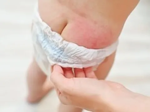 Rúng động: Phát hiện chất độc ảnh hưởng sinh sản trong hãng tã bỉm trẻ em Huggies, có thể ngấm vào máu và nước tiểu