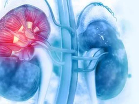 Khi thận suy hỏng, cơ thể sẽ đau ở 1 chỗ: Tiếc là nhiều người bỏ qua